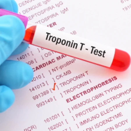 Pemeriksaan Troponin T di Amalia Medical Center