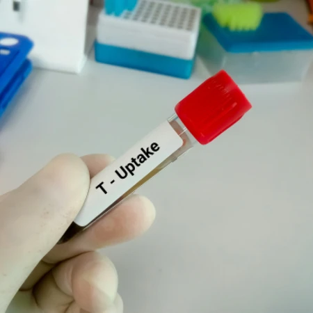 Pemeriksaan T-uptake di Amalia Medical Center