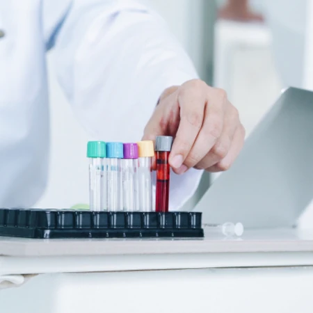 Pemeriksaan Viscositas Plasma di Amalia Medical Center