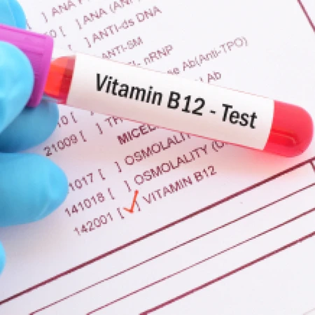 Pemeriksaan Vitamin B12 di Amalia Medical Center