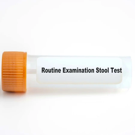 Pemeriksaan Feces Rutin di Amalia Medical Center