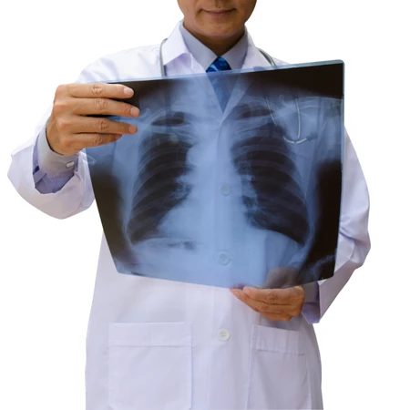 Radiologi (Thorax) di Amalia Medical Center