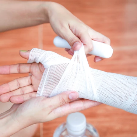 Luka Bakar Derajat Ringan di FastMed