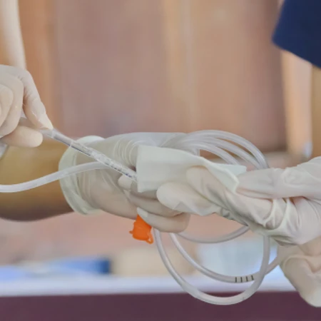 Pasang NGT Oleh Perawat di FastMed