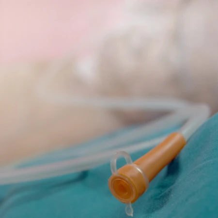 Pasang Aff NGT di FastMed