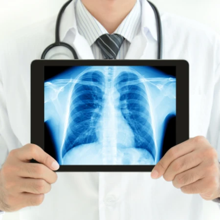 Portable X Ray di FastMed