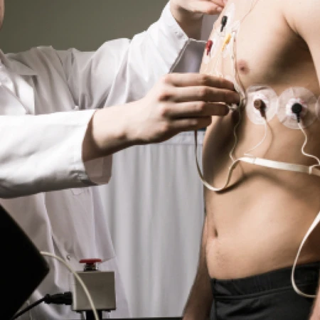 Pemeriksaan EKG di FastMed