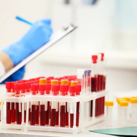 Pemeriksaan Darah Rutin di FastMed