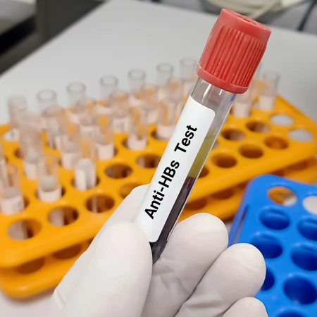 Pemeriksaan Hati (Anti HbS Rapid Test) di FastMed