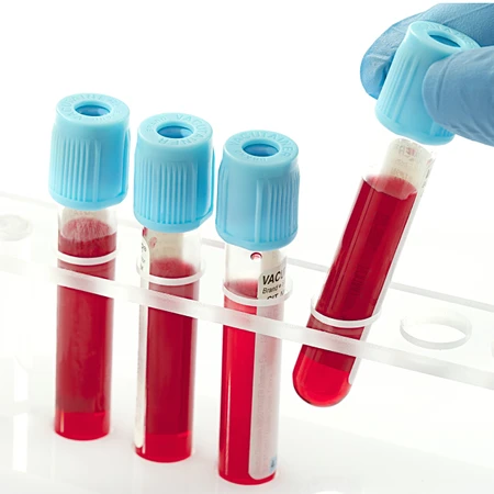 Pemeriksaan Kolesterol (HDL) di FastMed