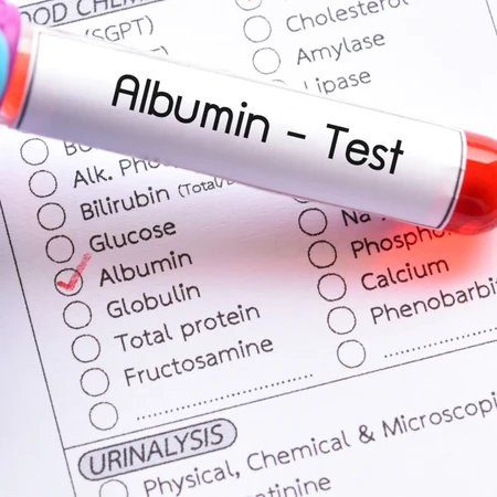 Pemeriksaan Hati (Albumin dan Globulin) di FastMed