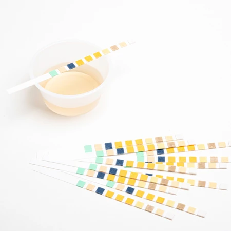 Pemeriksaan Urine Lengkap di FastMed