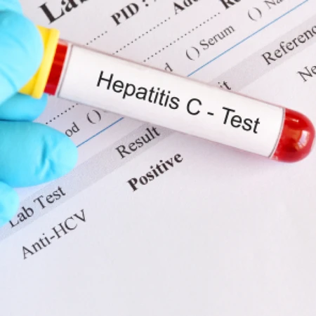 Pemeriksaan Hati (Anti HCV/Hepatitis C) di FastMed