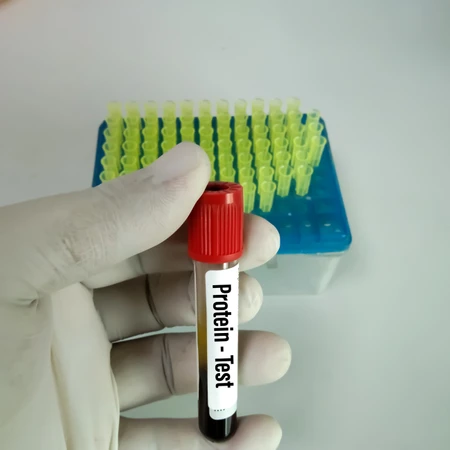 Pemeriksaan Protein Total di FastMed