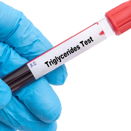 Pemeriksaan Trigliserida di FastMed