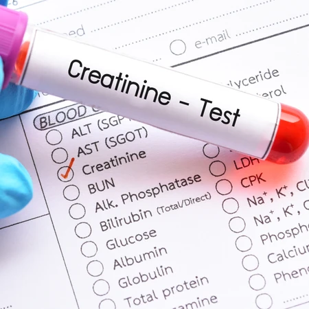 Pemeriksaan Creatinin di FastMed