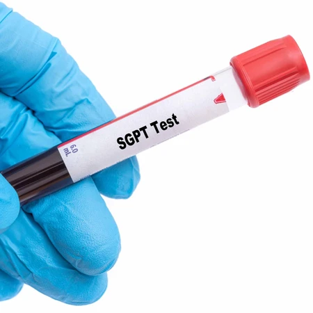 Pemeriksaan Hati (SGPT) di FastMed