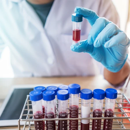 Pemeriksaan Golongan Darah dan Rhesus di FastMed