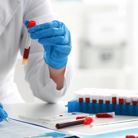 Pemeriksaan Feces Rutin di FastMed