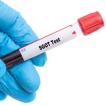 Pemeriksaan Hati (SGOT) di FastMed