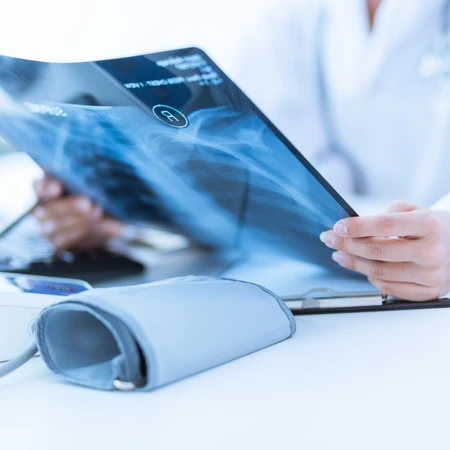 Pemeriksaan Rontgen di FastMed