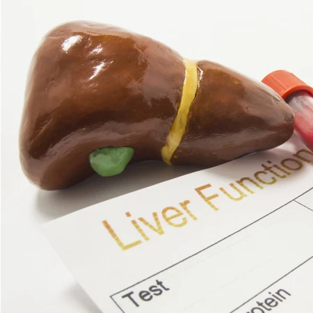 Pemeriksaan Hati: Waspada Hepatitis 1 (2 Tes) di FastMed