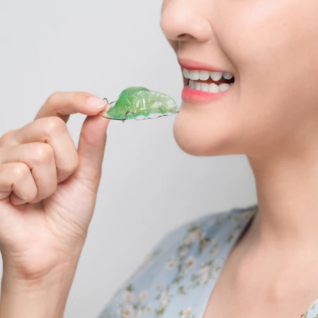 Fixed Retainer (Rahang atas dan rahang bawah) di Klinik Surya Medika