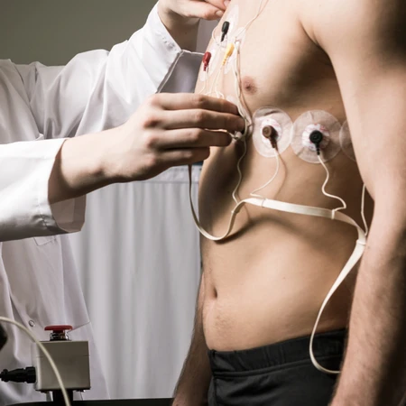 EKG Tanpa Ekspertise Dokter di Klinik Surya Medika