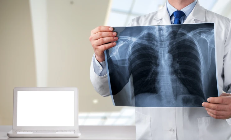 Rontgen Thorax PA di Fullerton Health Clinic