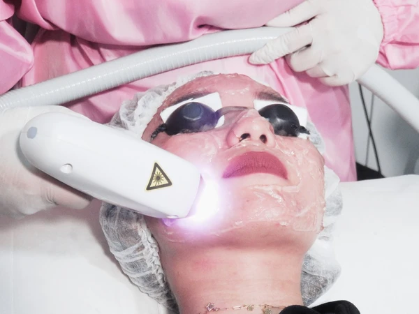 Cold Rejuvenation Laser (First Time Purchase) di Pure Laser Clinic Jakarta