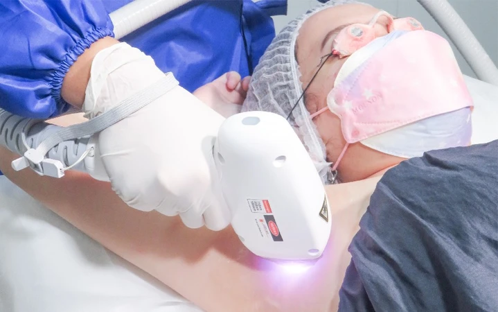 First Time Purchase: Underarms Hair Removal Laser 1x di Pure Laser Clinic