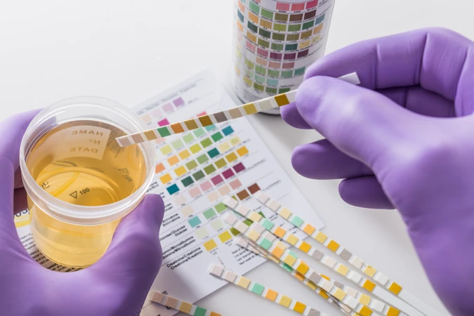 Pemeriksaan Urine Lengkap di ScanMe Labs