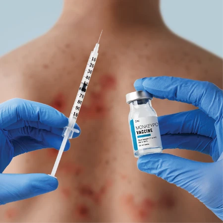 Vaksin Cacar Air di Klinik FIT