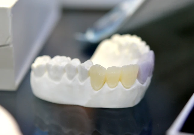 Rontgen Gigi 3D di CS Dental