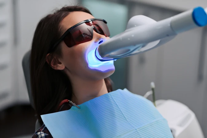 Bleaching Gigi dengan LED di Shiny Smile Dental