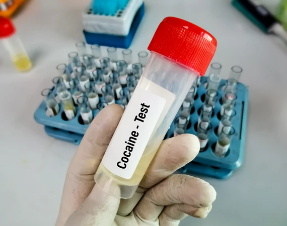 Tes Narkoba (6 Panel) di RS Kartika Husada Setu