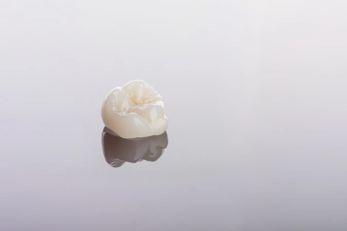 Pencabutan Gigi Kasus Sulit oleh drg. Umum di Passion Dental Care