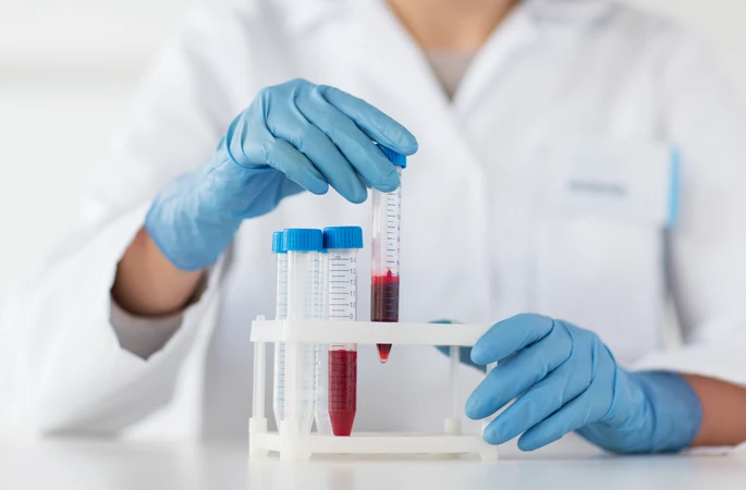 Pemeriksaan Immunologi Serologi IgG Anti Mycoplasma Pneumonia di ScanMe Labs