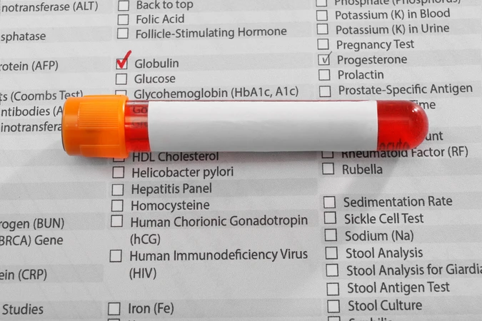 Pemeriksaan Kultur Urine + Resistensi di ScanMe Labs
