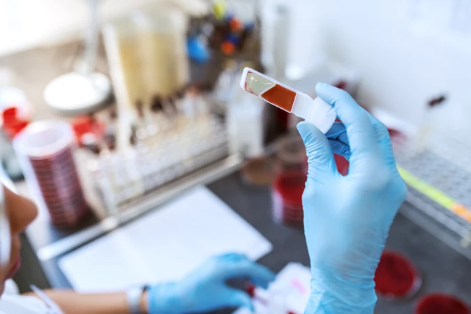 Pemeriksaan Kultur + Resistensi Pewarnaan Tinta India di ScanMe Labs