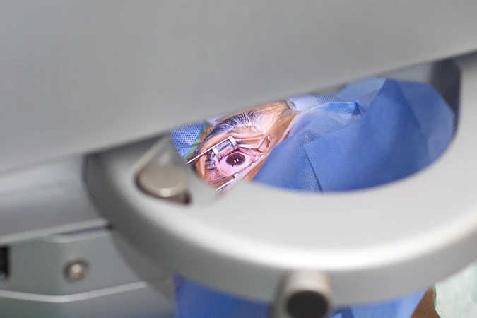 Tindakan ICL Non Toric 1 Mata di Klinik Utama JHC (Kardia Eye Center)