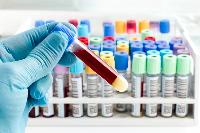 Pemeriksaan IgE Total (MEIA) di NMC Clinic & Laboratory
