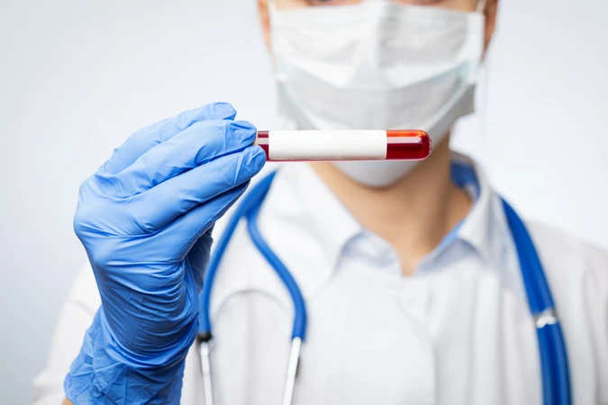 Pemeriksaan CA 125 (Payudara) di NMC Clinic & Laboratory