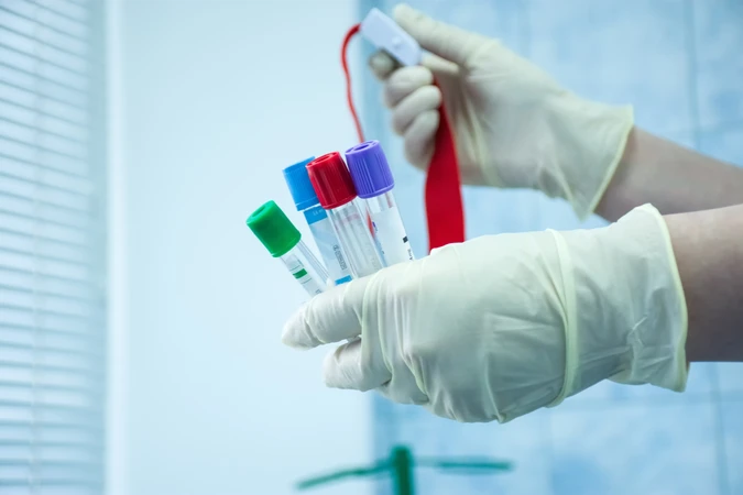 Pemeriksaan TIBC di NMC Clinic & Laboratory