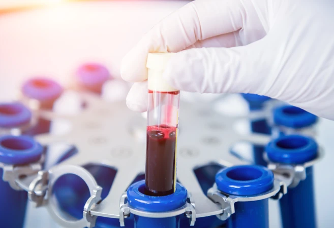 Pemeriksaan T4 Total di NMC Clinic & Laboratory