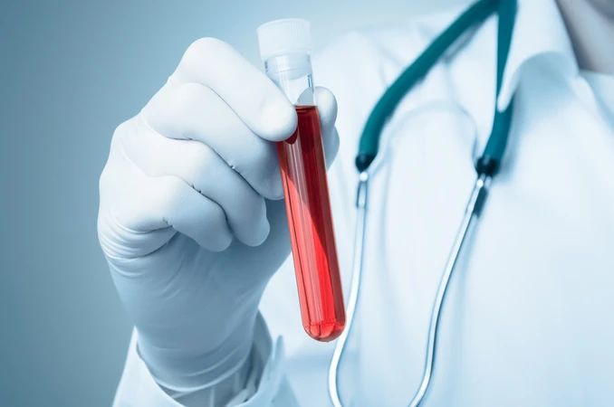 Pemeriksaan Toxoplasma IgM di GWS Medika