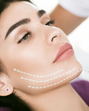 Mini Facelift di NULOOK Anti Aging & Regenerative Center