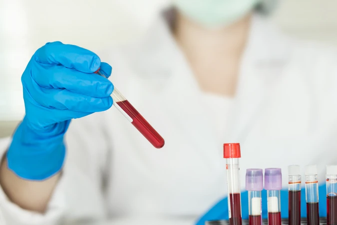 Pemeriksaan Cholinesterase (CHE) di Klinik Galaxy Medical Center