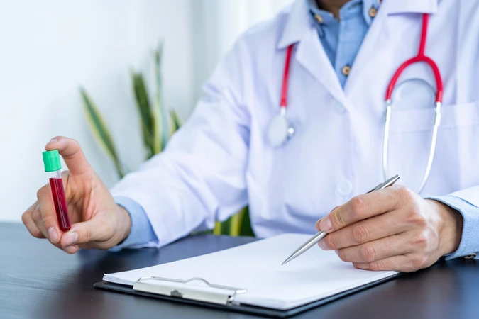 Pemeriksaan HCV-RNA Kuantitatif di AIC Medical Clinic