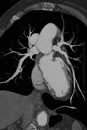 MSCT Scan Angiography Cardiac di RS Jantung Jakarta